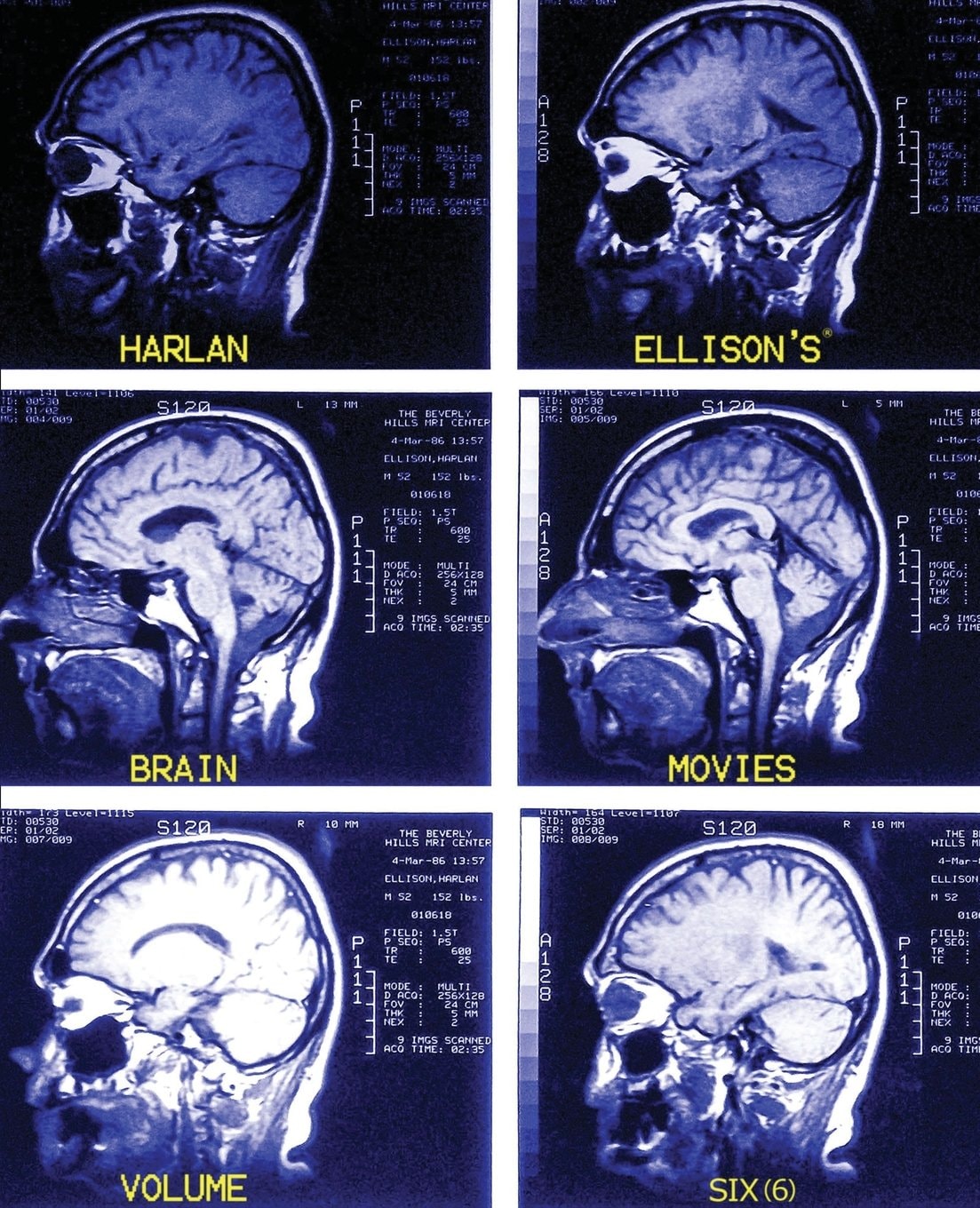 Brain Movies The Original Teleplays of Harlan Ellison