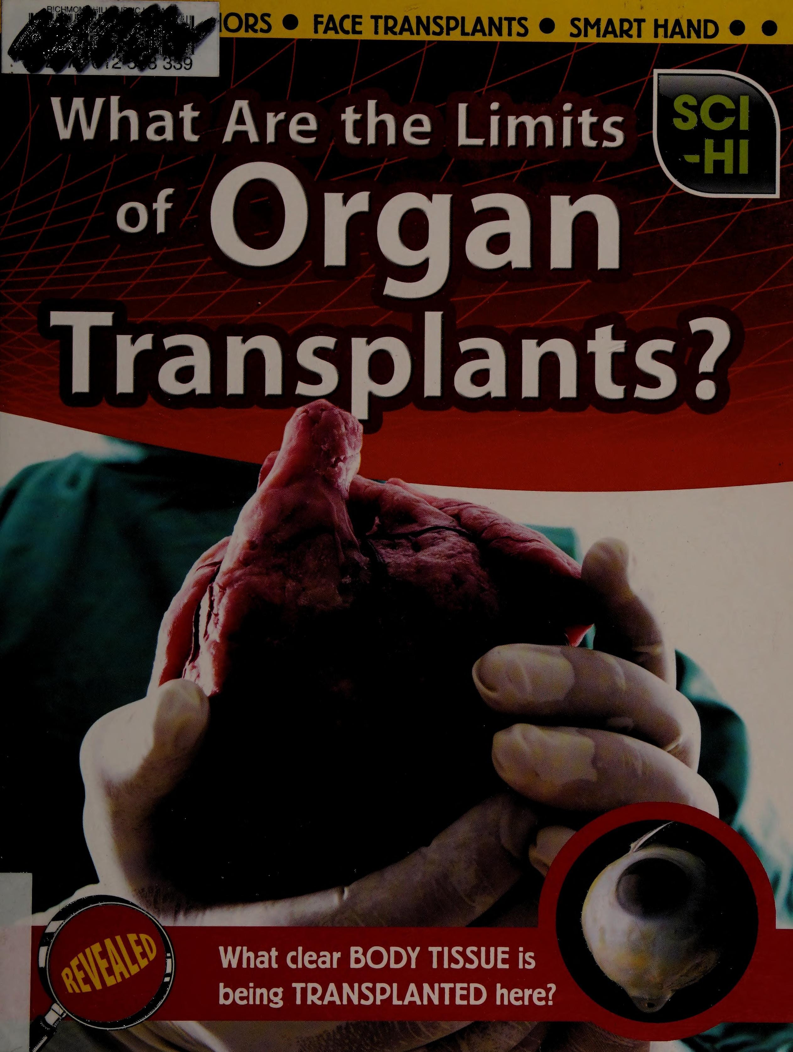 What Are the Limits of Organ Transplants?
