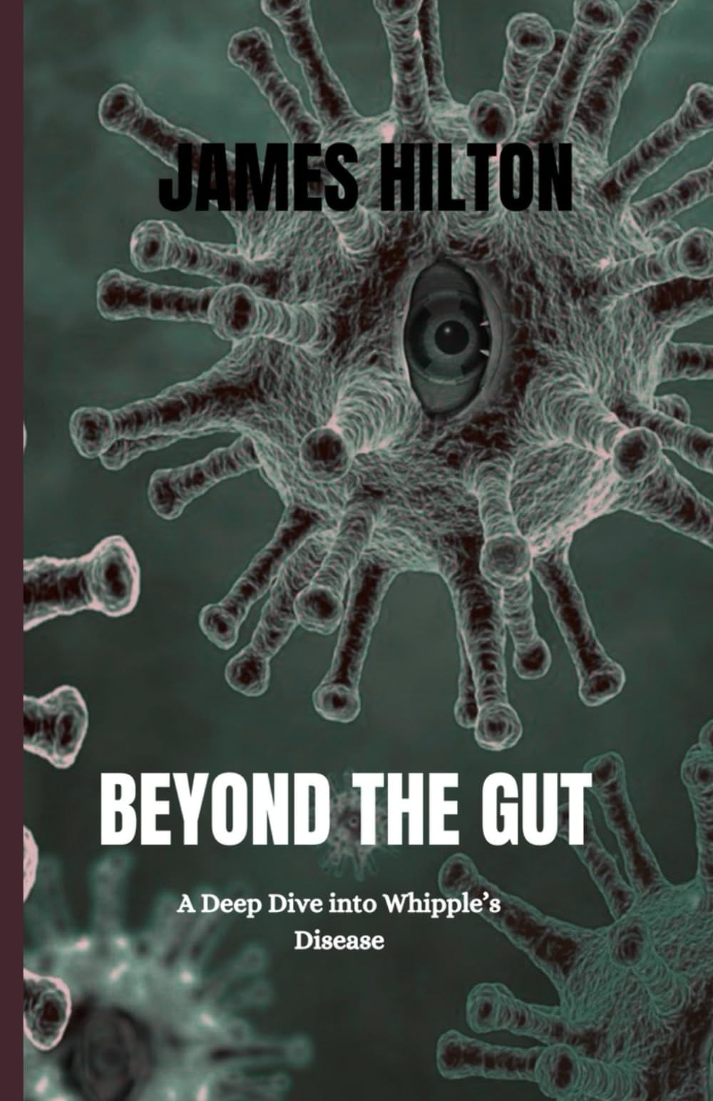 Beyond the Gut - A Deep Dive Into Whipple's Disease